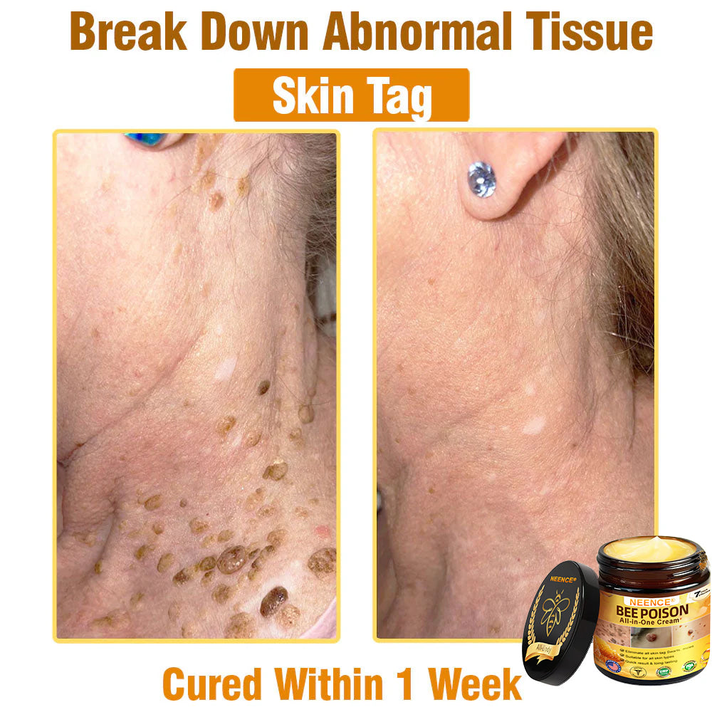 NEENCE™ Bee Poison All-in-One Cream US Dermatologist Approved